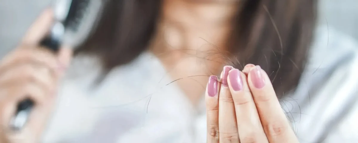 ریزش مو هورمونی – علائم و درمان